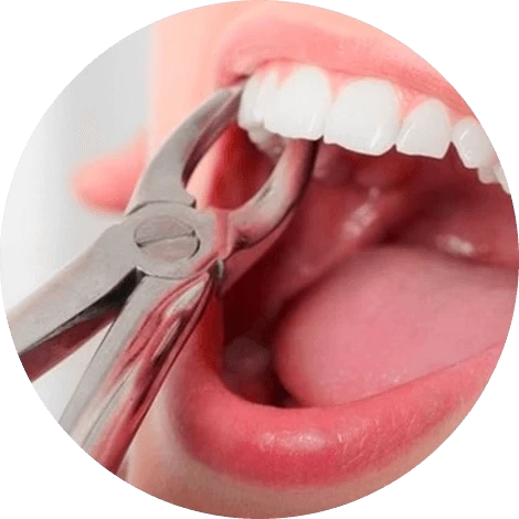 Баннер Удалить зуб Баннер Удалить зуб